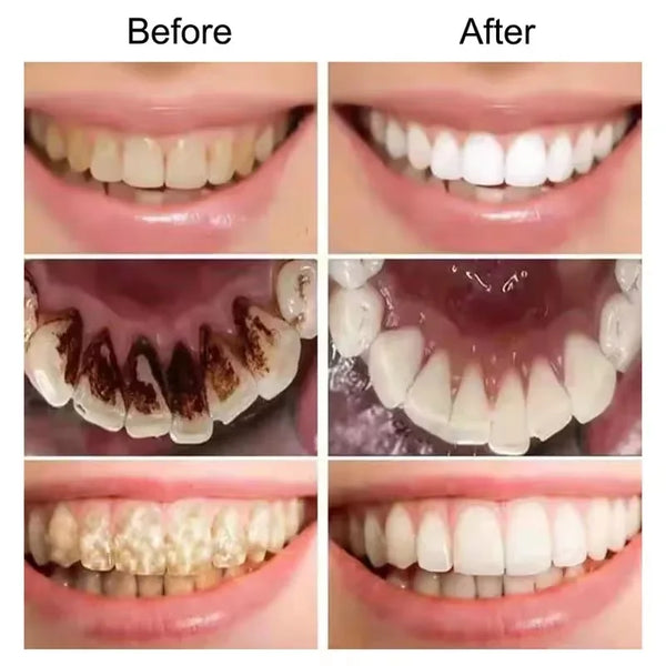 V34-Purple-Teeth-Whitening-Toothpaste-Remove-Plaque-Stains-Cleaning-Oral-Hygiene-Dental-Bleach-Tools-Fresh-Breath.png